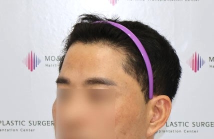 치료후기 이미지